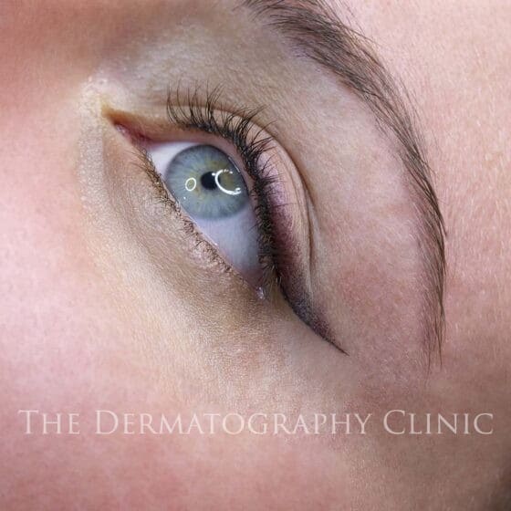 Permanent Eyeliner Treatments in London