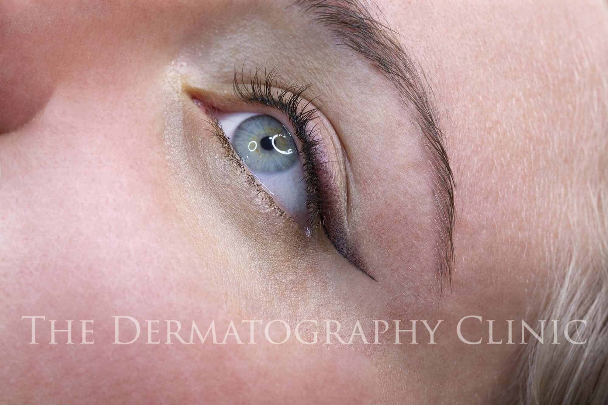 den første Observation sofistikeret Permanent Eyeliner - The Dermatography Clinic