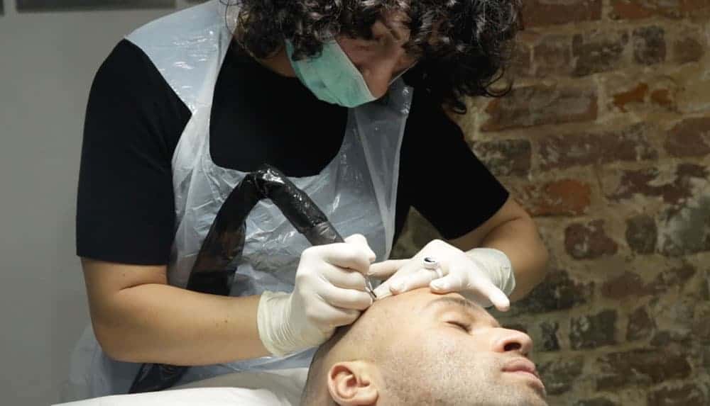 Renée performing scalp micropigmentation at The Dermatography Clinic
