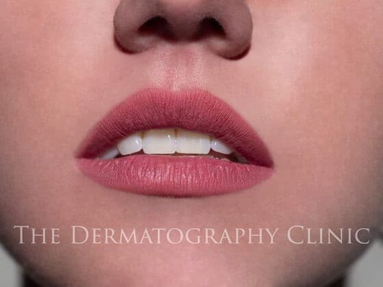 Premium Photo | Young woman with permanent makeup on her lips in a  cosmetologists salon permanent makeup tattoo