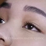 Nano Stroke Brows Treatment