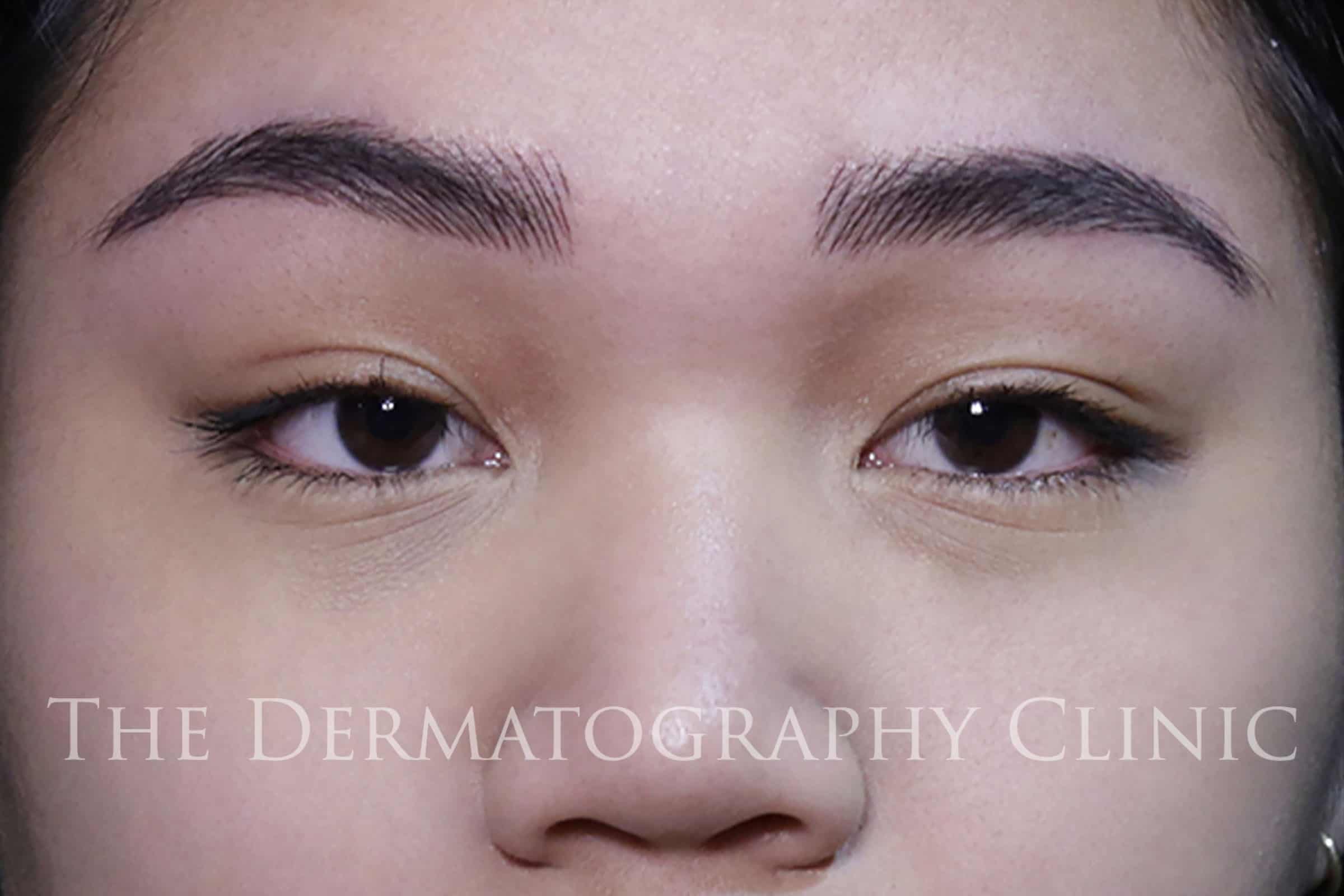 Alya Permanent Eyebrows After