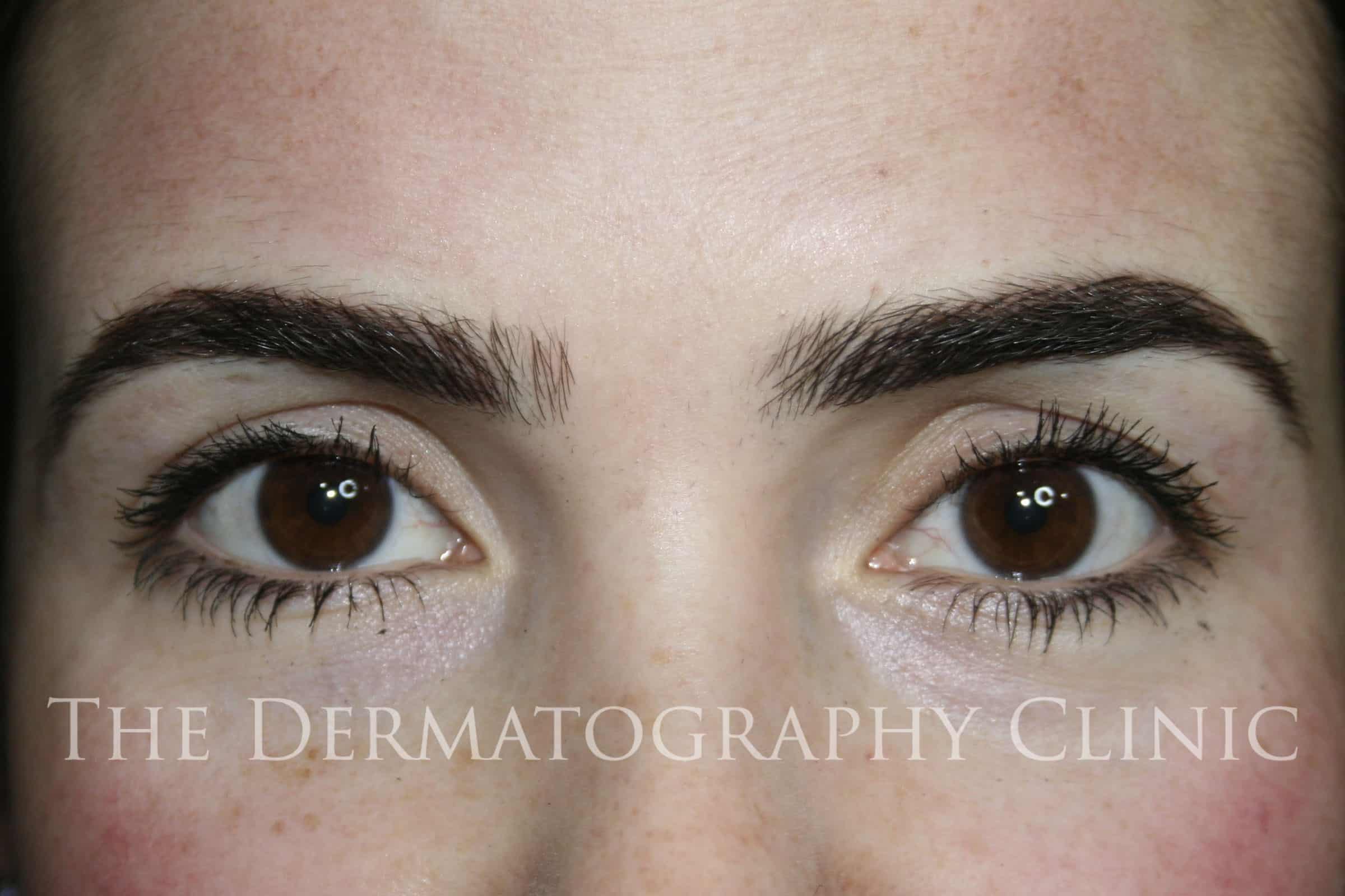Erica Permanent Eyebrows After