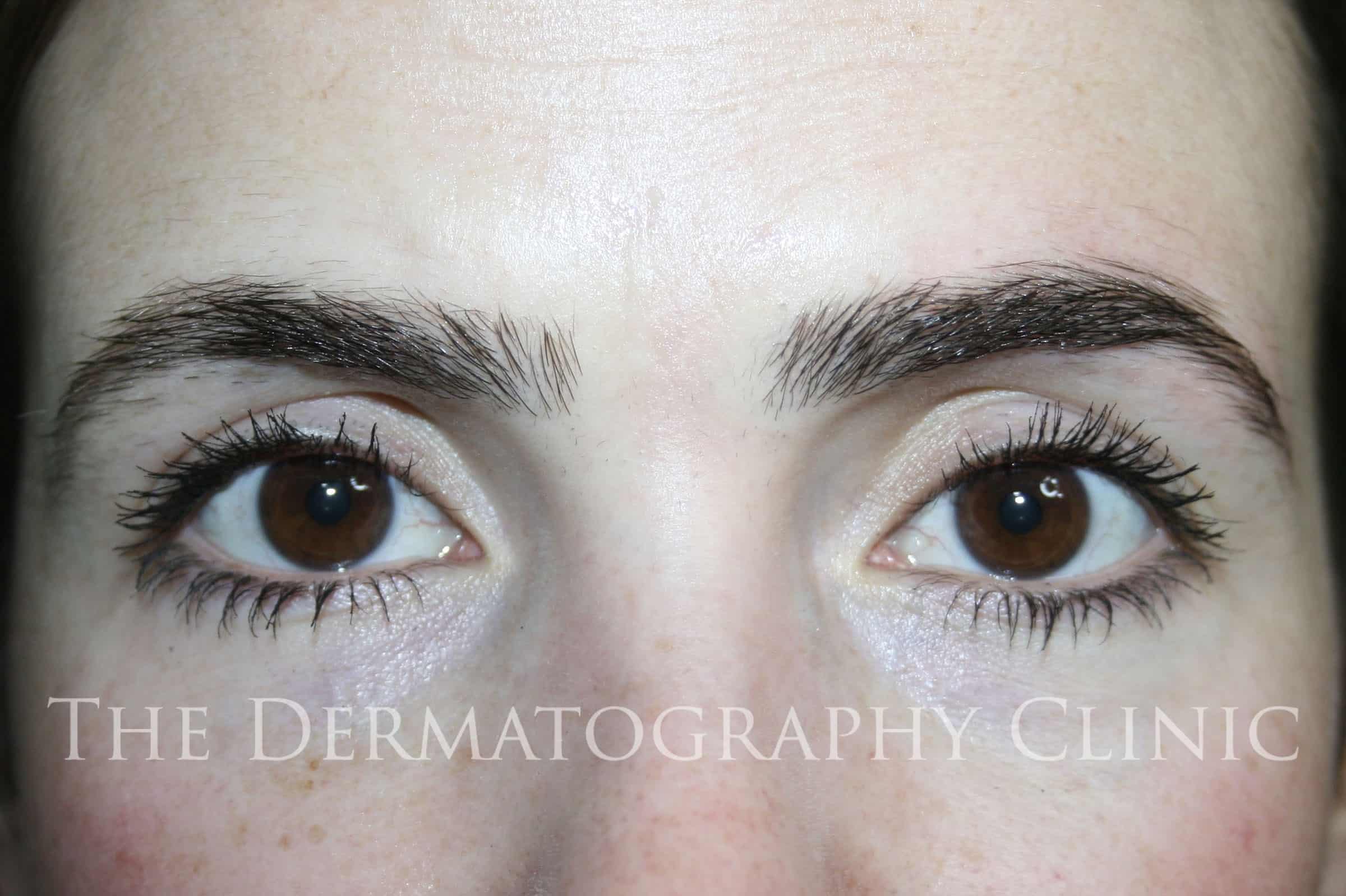 Erica Permanent Eyebrows Before