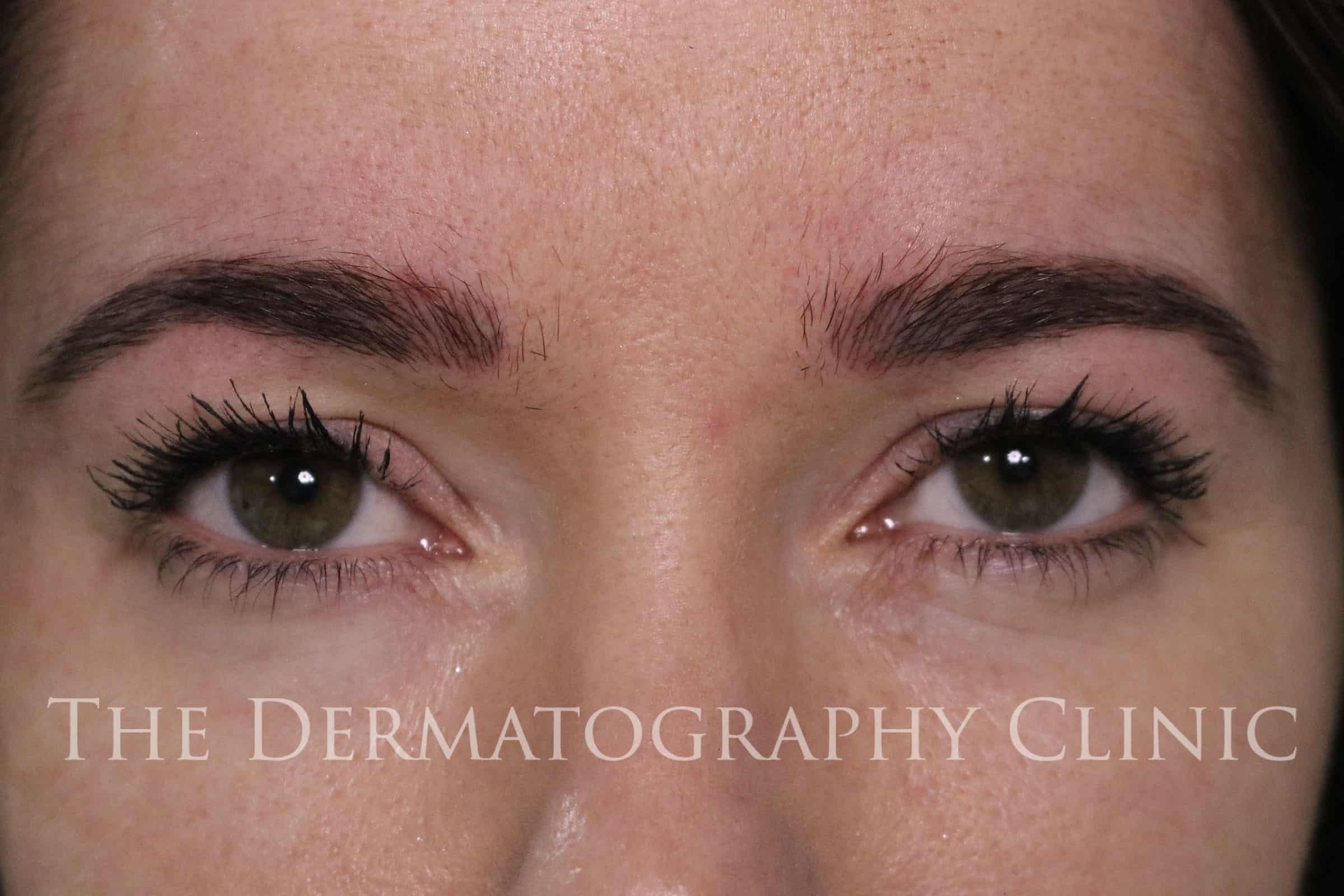Helen Permanent Eyebrows After