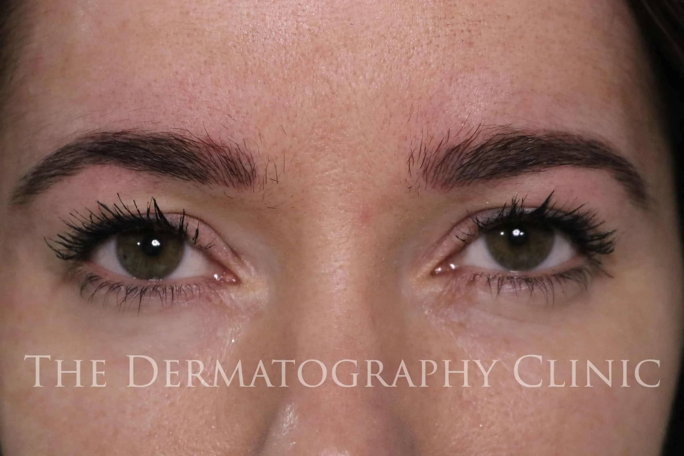 Helen Permanent Eyebrows After