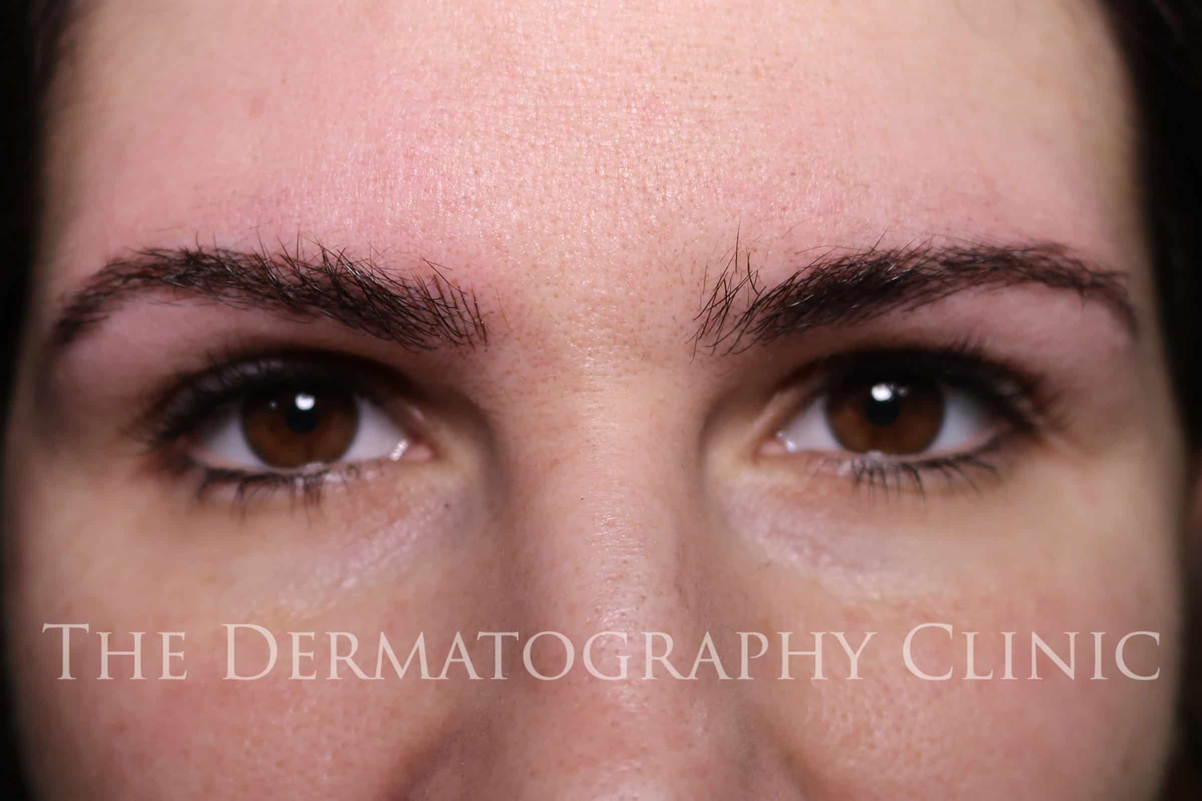 Natasha Permanent Eyebrows After