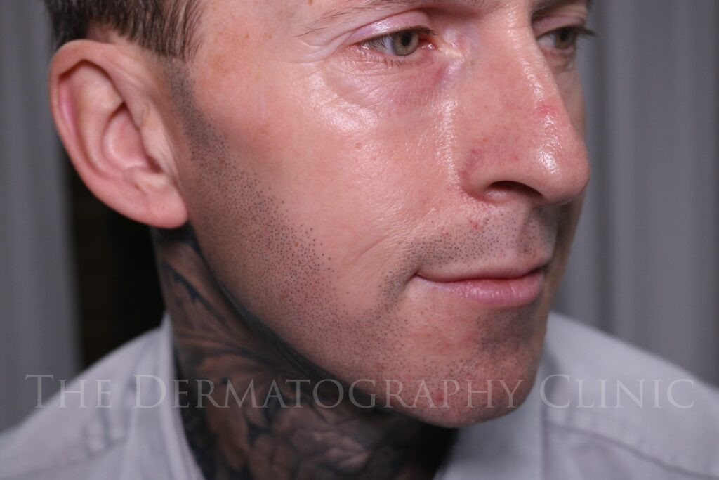 Close-up of man’s face with stubble tattoo