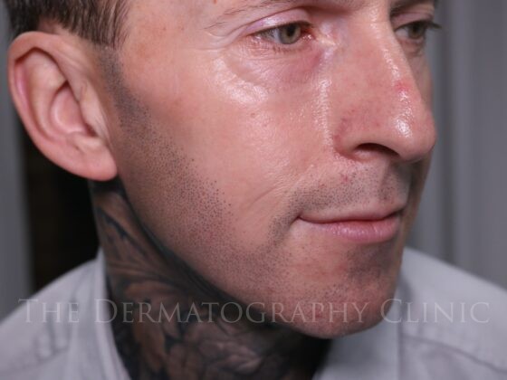 Close-up of man’s face with stubble tattoo
