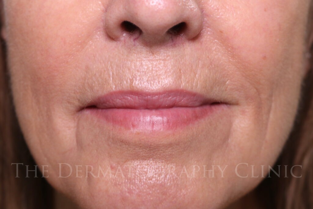 Lip blush tattoo enhancement before and after images for mature client