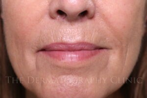 Lip blush tattoo enhancement before and after images for mature client
