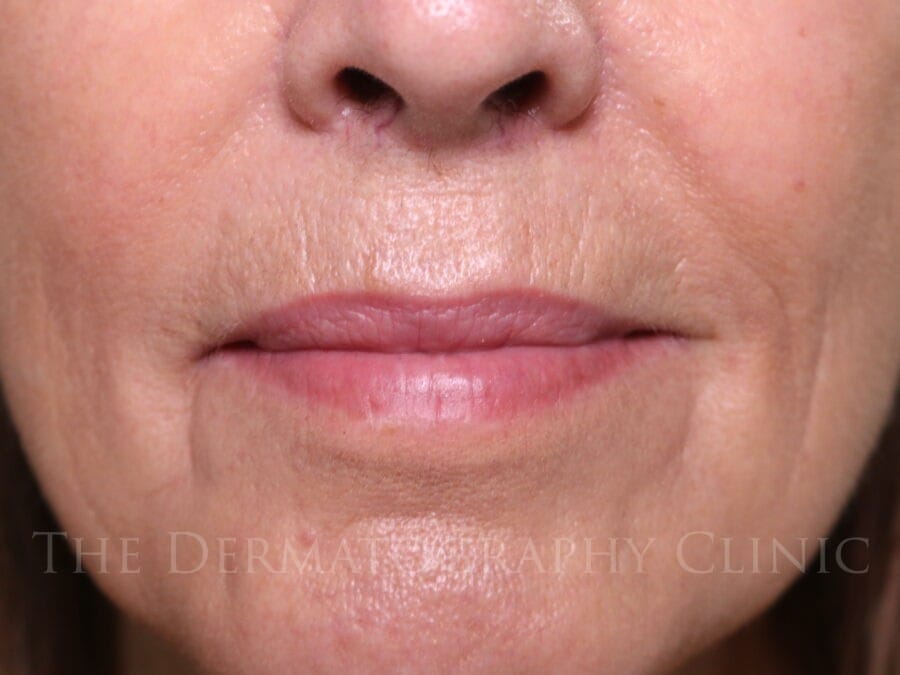 Lip blush tattoo enhancement before and after images for mature client