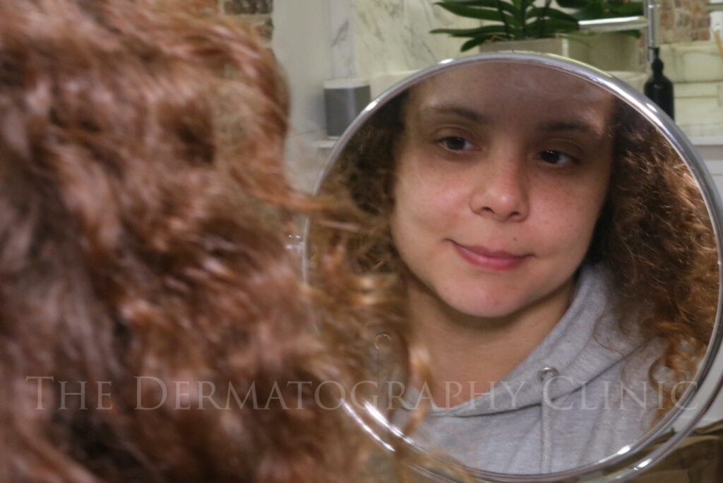Woman looking at her reflection in a mirror before female scalp micropigmentation consultation