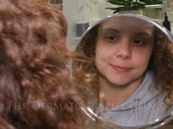 Woman looking at her reflection in a mirror before female scalp micropigmentation consultation