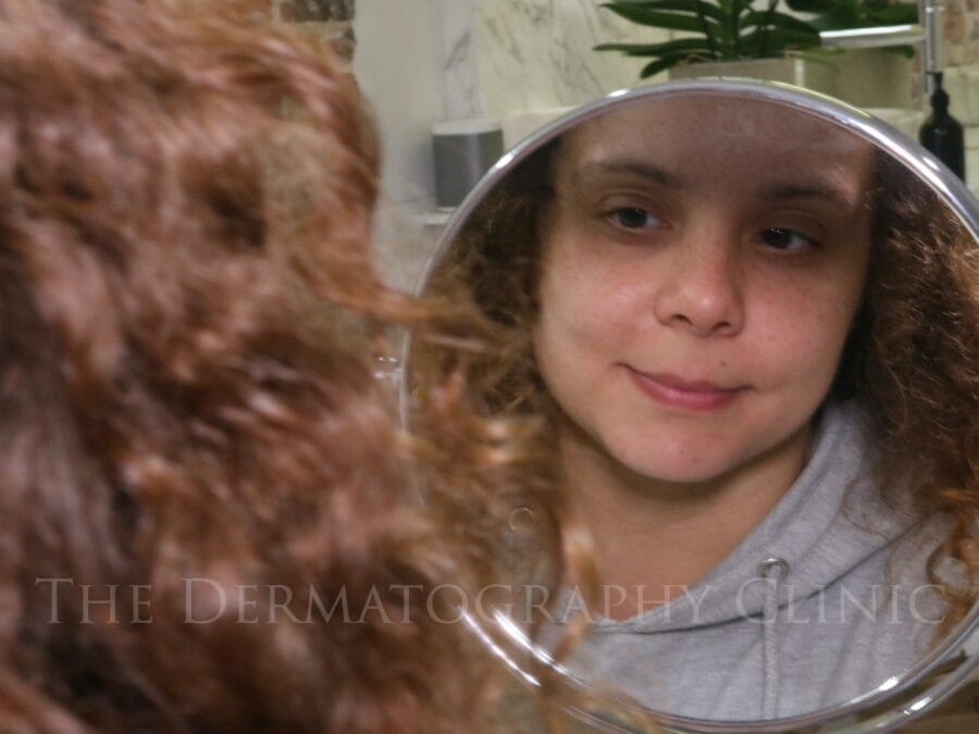 Woman looking at her reflection in a mirror before female scalp micropigmentation consultation